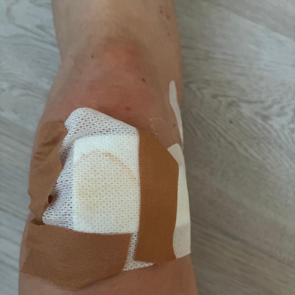 knie en schaafwonden